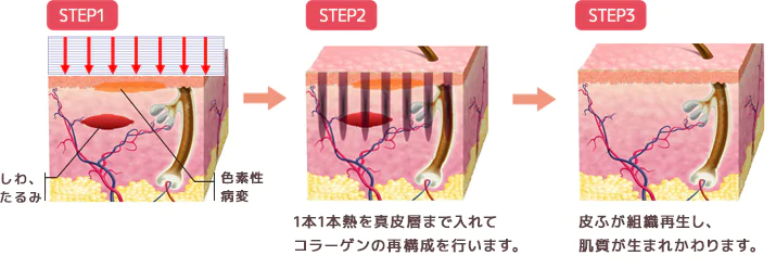 お肌へのアプローチ図