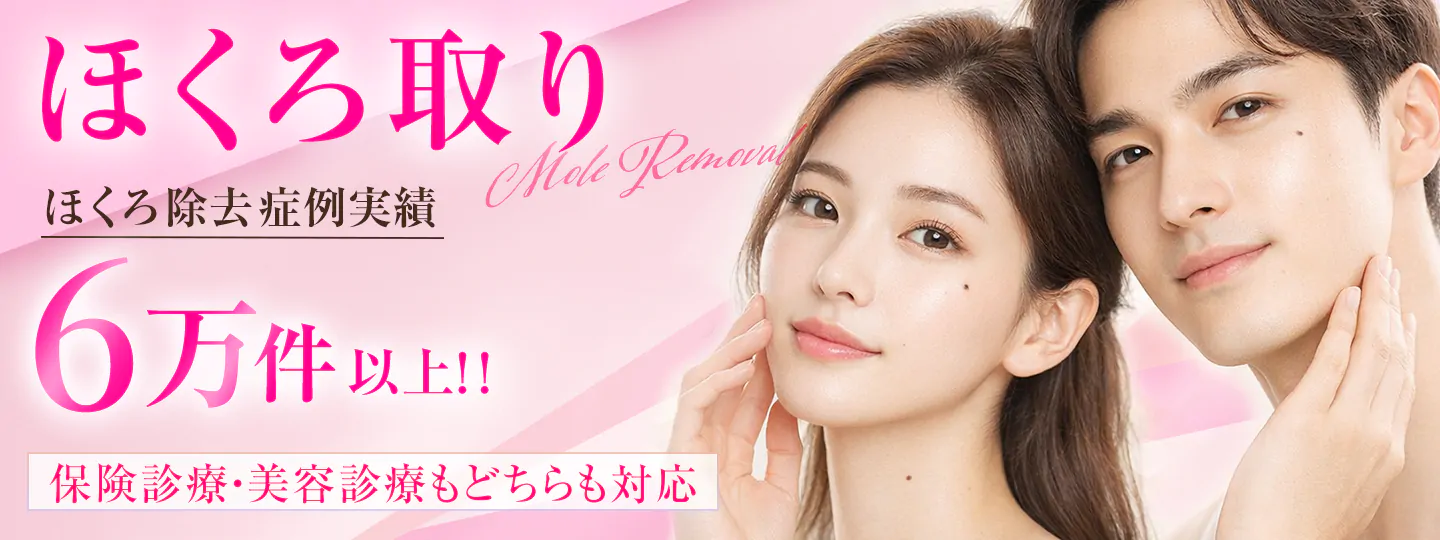 ほくろ取り